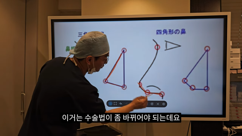 사각코성형 방법으로 돌출입개선효과와 자연스러운코를 만들어 보세요. 사진 10