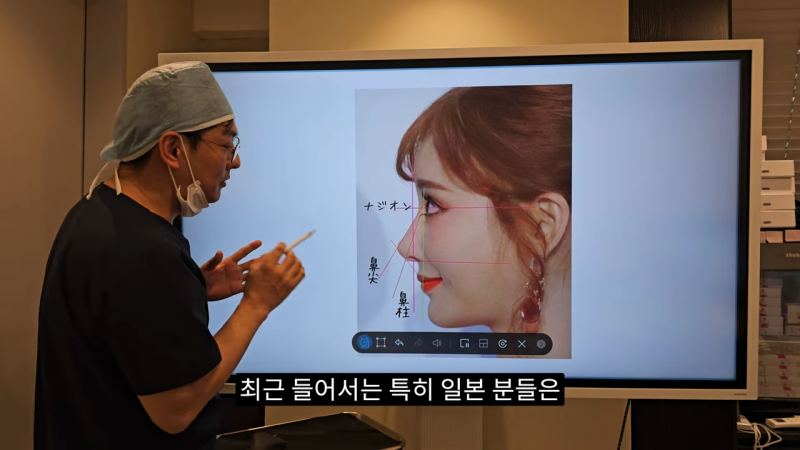 사각코성형 방법으로 돌출입개선효과와 자연스러운코를 만들어 보세요.