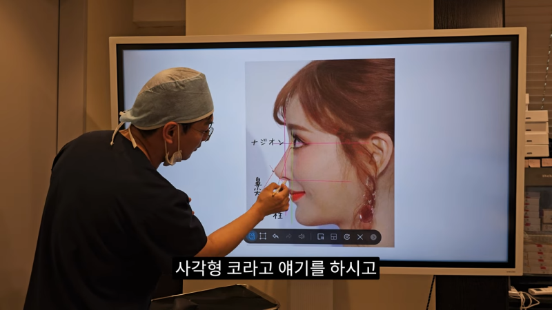 사각코성형 방법으로 돌출입개선효과와 자연스러운코를 만들어 보세요.