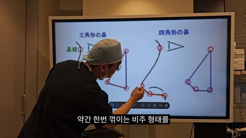 사각코성형 방법으로 돌출입개선효과와 자연스러운코를 만들어 보세요. 사진 9
