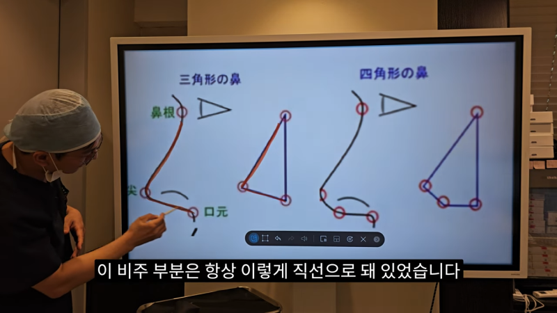 사각코성형 방법으로 돌출입개선효과와 자연스러운코를 만들어 보세요. 사진 4