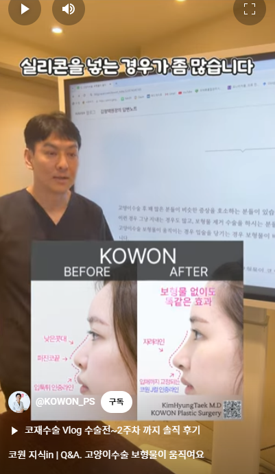 비순각수술하고 코보형물 움직임, 비주붓기 증세가 있어요! 해결 방법은?