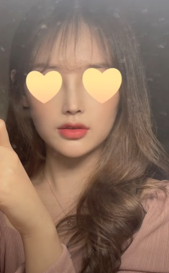 긴코수술은 어떻게 이루어질까? 그리고 화살코, 처진코원인은? 사진 13