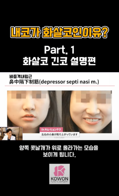 긴코수술은 어떻게 이루어질까? 그리고 화살코, 처진코원인은? 사진 7