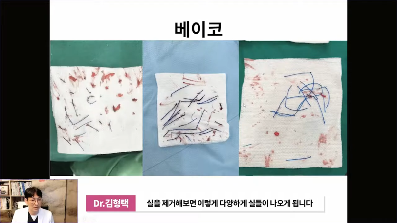 베이코 코실리프팅 시술 후 이물질제거하는 이유는 뭘까? 사진 9