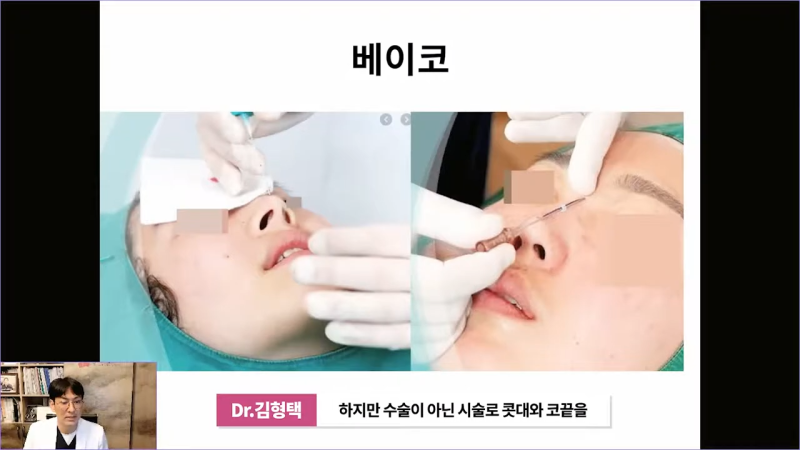 베이코 코실리프팅 시술 후 이물질제거하는 이유는 뭘까? 사진 4