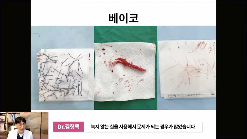 베이코 코실리프팅 시술 후 이물질제거하는 이유는 뭘까? 사진 12