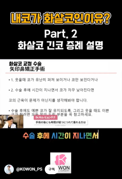 화살코 교정 긴코성형의 포인트! 자려한코가 되는 방법은? 사진 5