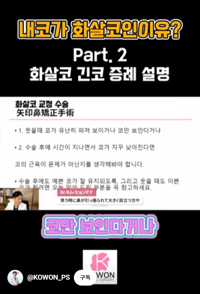 화살코 교정 긴코성형의 포인트! 자려한코가 되는 방법은? 사진 4