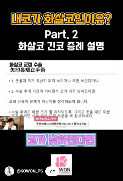 화살코 교정 긴코성형의 포인트! 자려한코가 되는 방법은? 사진 6