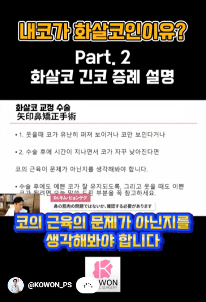 화살코 교정 긴코성형의 포인트! 자려한코가 되는 방법은? 사진 7