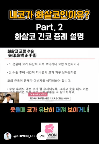 화살코 교정 긴코성형의 포인트! 자려한코가 되는 방법은? 사진 3