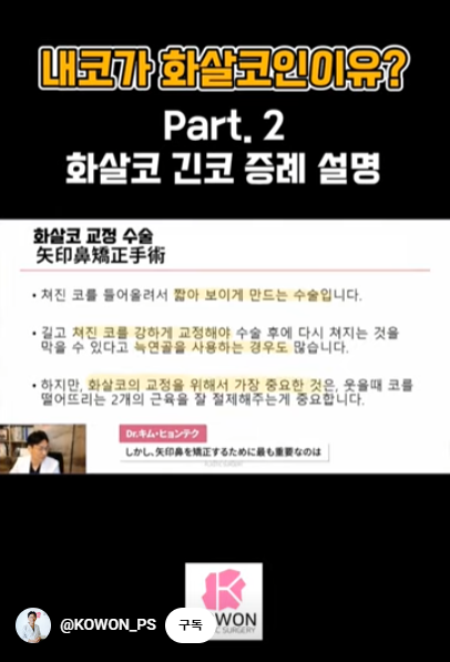 화살코 교정 긴코성형의 포인트! 자려한코가 되는 방법은?