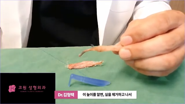 하이코 실리프팅 시술 후 염증 발생 가능성, 실제거 해야 할까? 사진 7