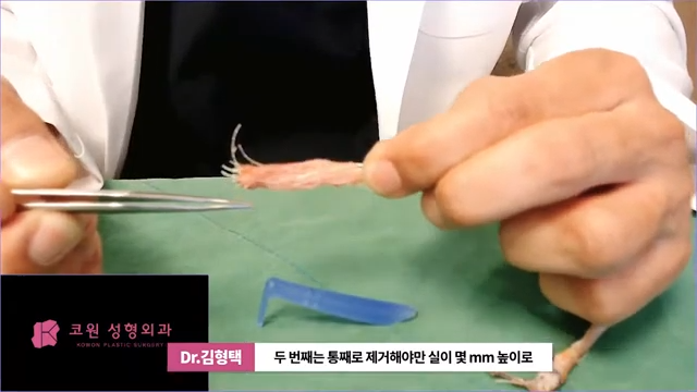 하이코 실리프팅 시술 후 염증 발생 가능성, 실제거 해야 할까? 사진 6