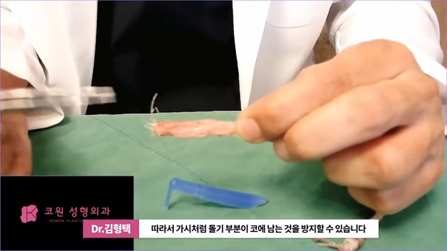 하이코 실리프팅 시술 후 염증 발생 가능성, 실제거 해야 할까? 사진 5