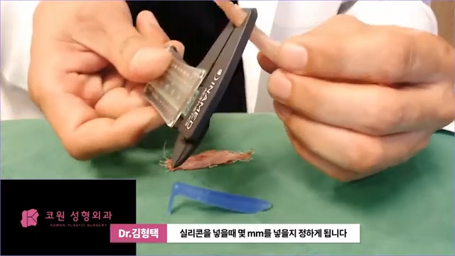 하이코 실리프팅 시술 후 염증 발생 가능성, 실제거 해야 할까? 사진 8