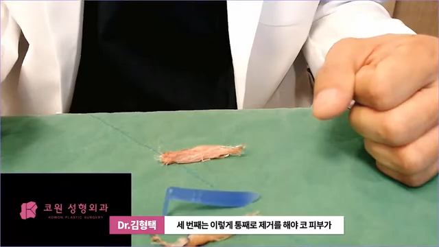 하이코 실리프팅 시술 후 염증 발생 가능성, 실제거 해야 할까? 사진 10