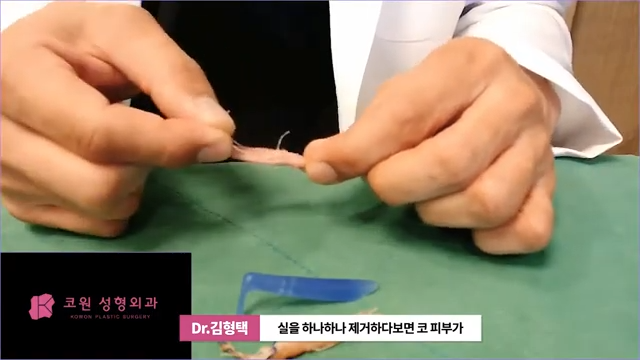 하이코 실리프팅 시술 후 염증 발생 가능성, 실제거 해야 할까? 사진 12