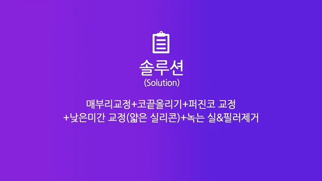 논현역성형외과 여자 매부리코 교정 후 화려한 코로 개선 성공한 사례 사진 3