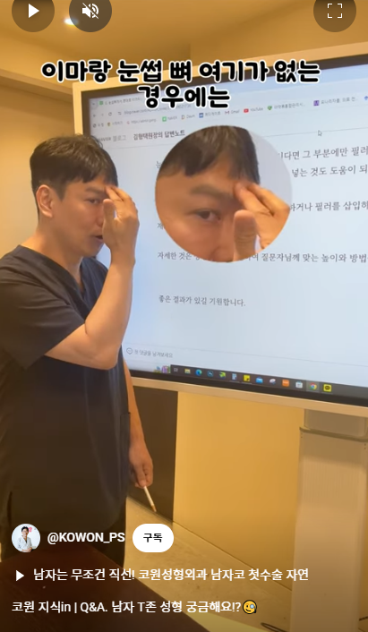 남자 코성형 자연스러운 직선코, 높은 콧대로 변신! 사진 6