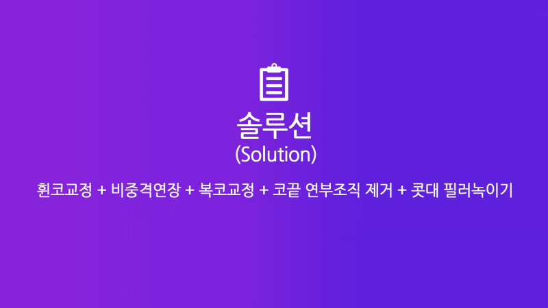 여자복코, 뚱뚱한코에서 화려하고 예쁜 코로 개선한 사례 사진 4