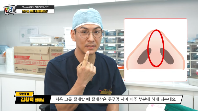 첫코성형 코재수술 차이, 코수술흉터 안 남는 법은?