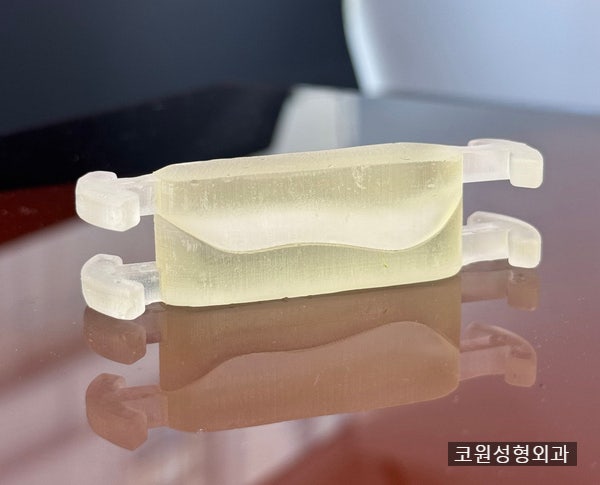 내 코에 딱 맞는 맞춤 늑연골 코성형 솔루션