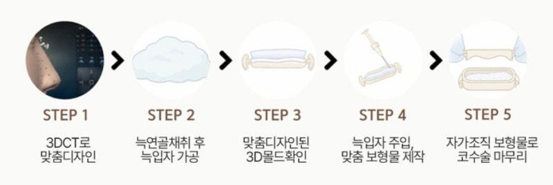 염증 코재수술, 이제는 조직 안정성이 우선입니다
