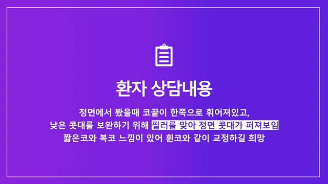 휜코교정 비중격연장으로 짧고 퍼진 콧대 개선한 사례