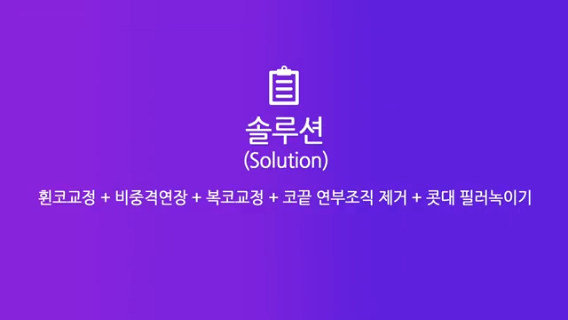 휜코교정 비중격연장으로 짧고 퍼진 콧대 개선한 사례 사진 3