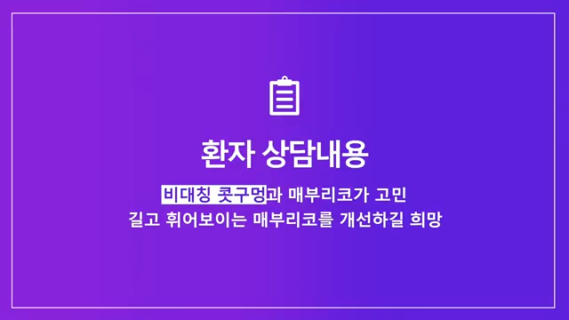 매부리코수술 코끝올리기로 콧구멍비대칭 개선한 사례