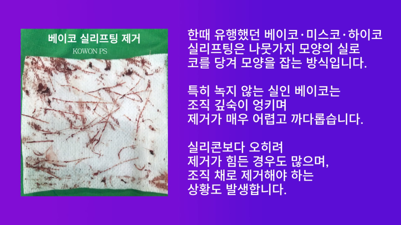 신사역코재수술, 쁘띠성형 코필러제거 깔끔하게 마친 사례 사진 4