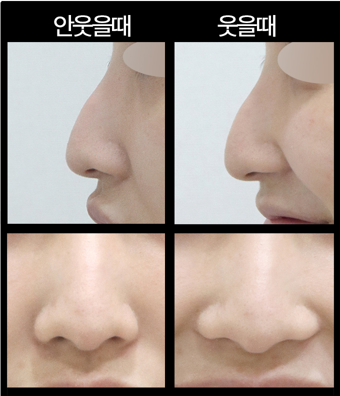 코원성형외과 김형택 원장, 경청으로 시작하는 진료 사진 11