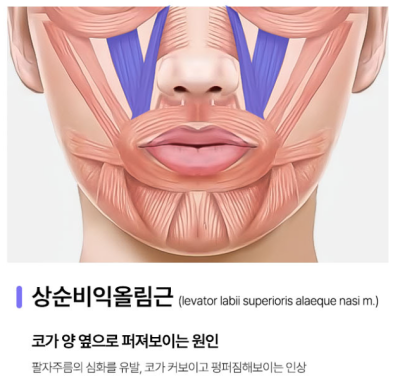 코근육교정, 웃을 때 퍼져 보이는 이유는 따로 있습니다. 사진 4