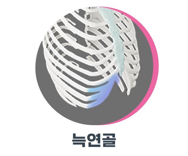 자가연골코수술 잘하는 곳은 다릅니다 사진 6