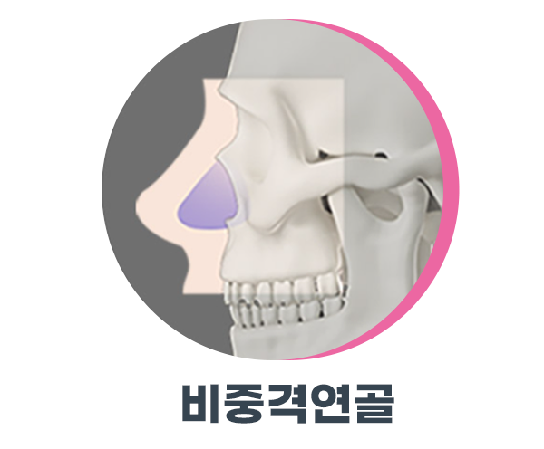 자가연골코수술 잘하는 곳은 다릅니다 사진 5