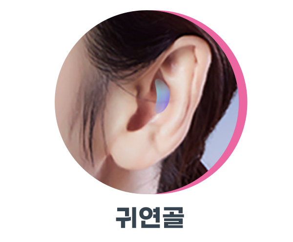 자가연골코수술 잘하는 곳은 다릅니다 사진 4