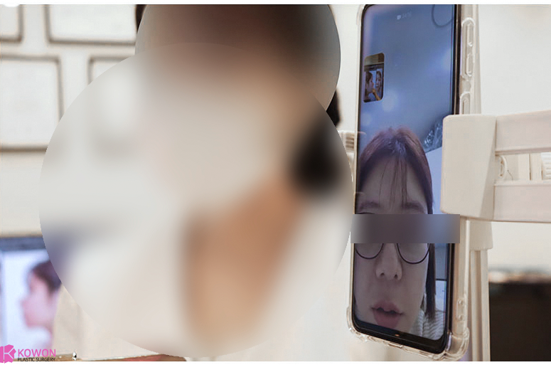 들창코수술비용 하나부터 열까지 다 알려드려요. 사진 7
