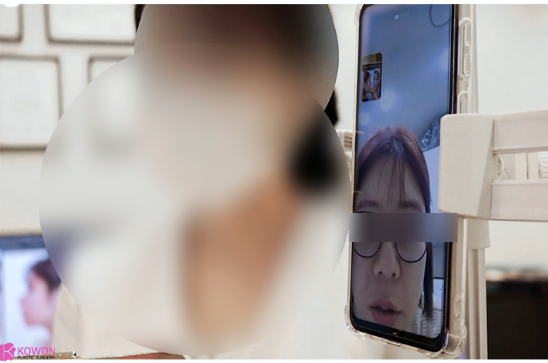 늑연골코성형 잘하는 곳? 딱 3가지만 알아보세요. 사진 9