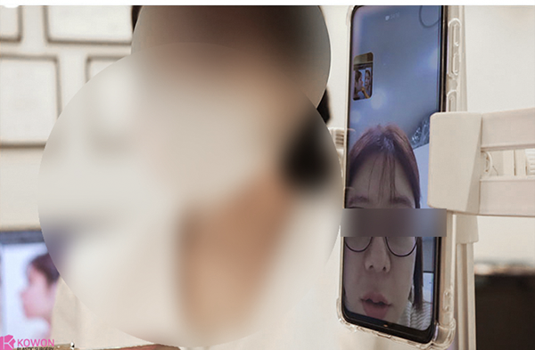 코성형술 잘하는 곳? 딱 3가지만 보세요. 사진 8