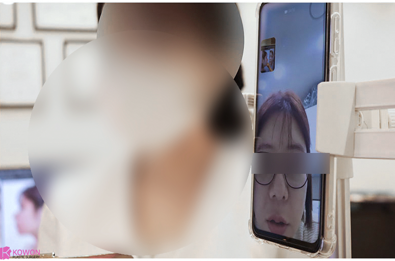 콧대수술비용 싸면 좋은걸까? 하나씩 비교해드립니다. 사진 6
