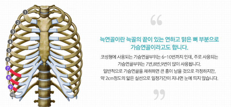 강남남자코수술 이렇게 하면 티 안 나고 잘생겨집니다. 사진 5