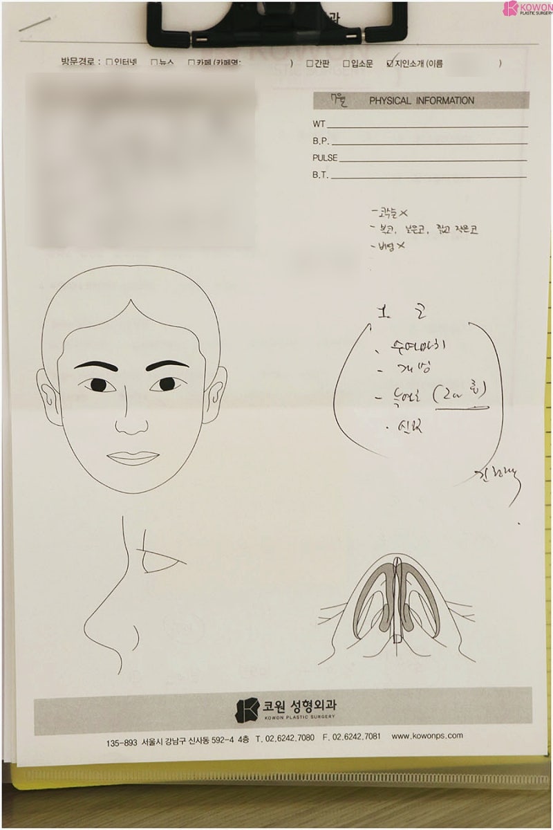 콧볼성형 실패하지 않기 위한 한 가지 꿀팁 사진 9