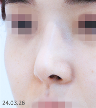 직반버선코, 자연스럽고 세련된 라인을 원한다면 필독 사진 6