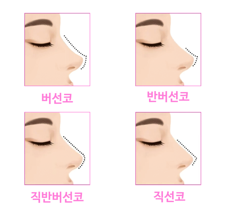 직반버선코, 자연스럽고 세련된 라인을 원한다면 필독 사진 3