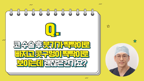 코성형붓기 빨리 빼는 법 전격 공개 사진 3