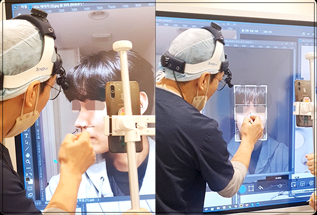 비공내리기, 자연스러운 코라인을 위한 핵심 포인트는? 사진 8