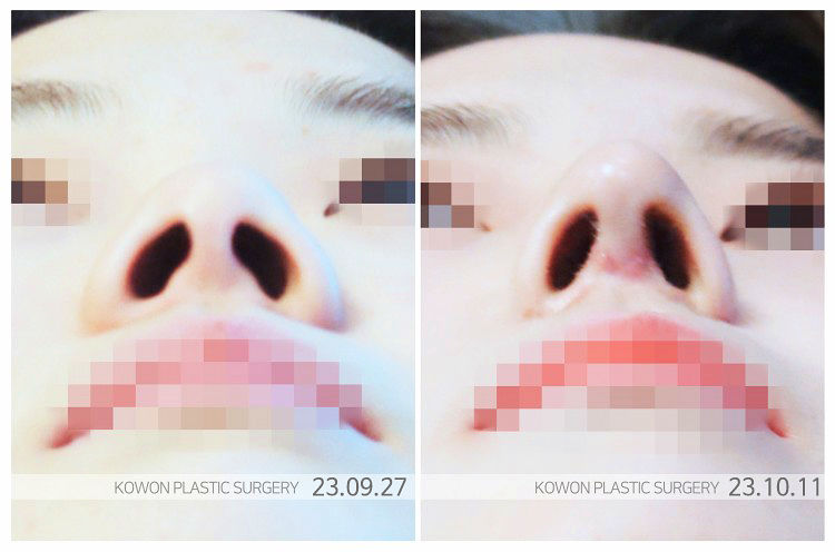 비공내리기, 자연스러운 코라인을 위한 핵심 포인트는? 사진 5