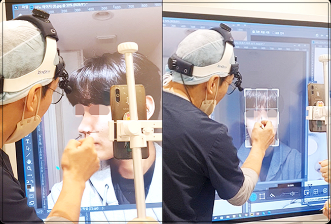 직선코, 사진보다 실물이 밋밋한 남성 필독 사진 4